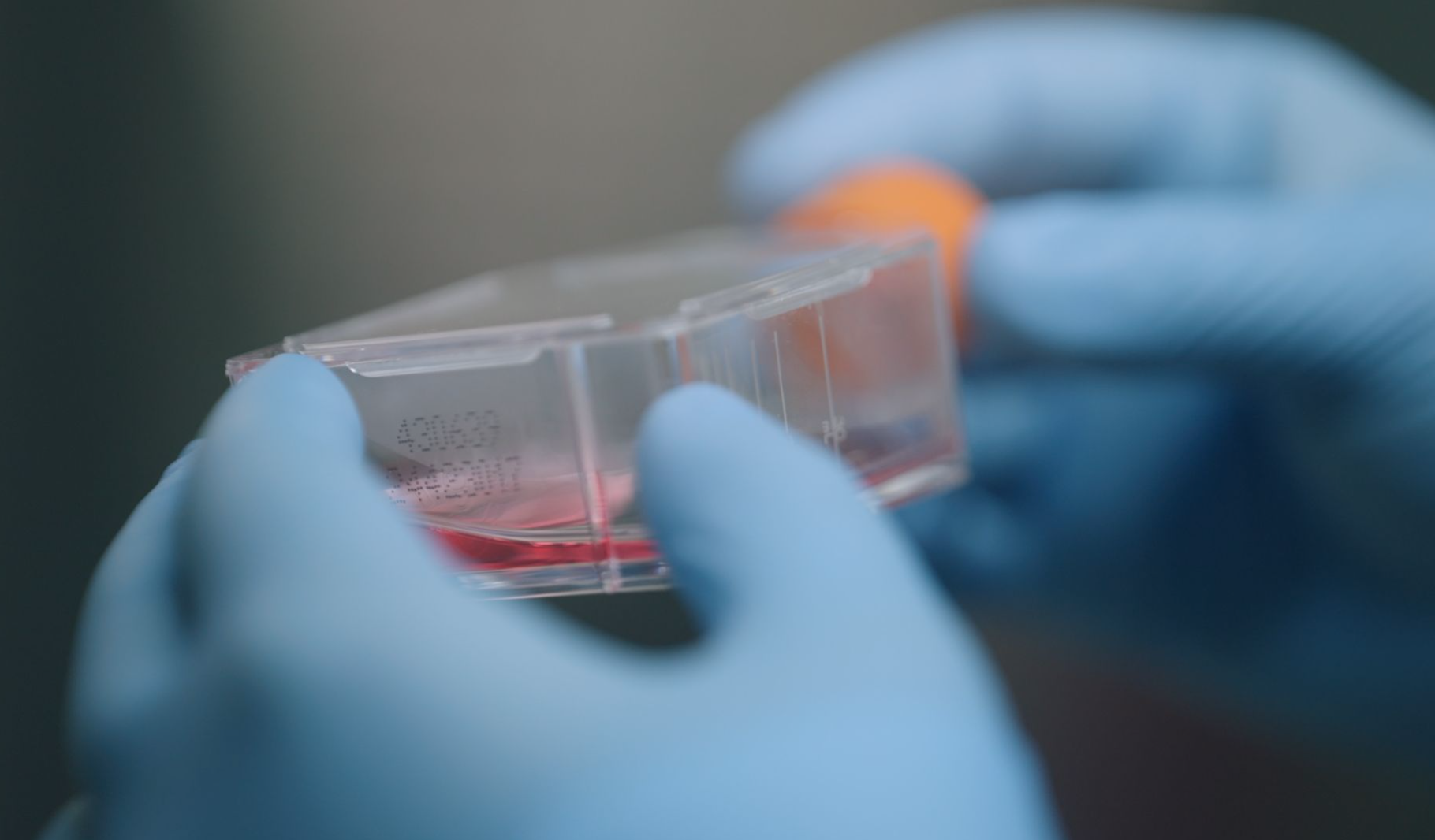 Close-up of gloved hands holding a cell culture flask with a red biological sample, representing the advanced cell-based research and metabolic therapies that underpin the Oasis of Hope IMPACT immunotherapy program.